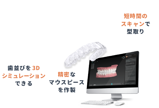 歯並びを3Dシミュレーションできる・精密なマウスピースを作製・短時間のスキャンで型取り